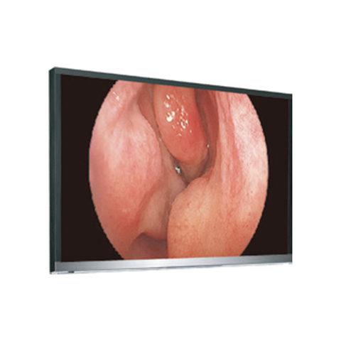 LCD Monitor