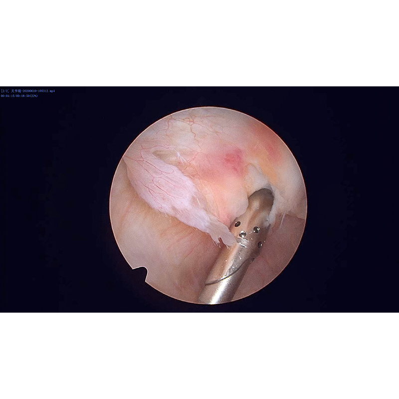 Arthroscopes 2.7 mm