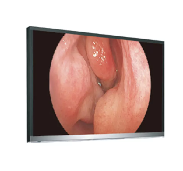 4K UHD Endoscopy System